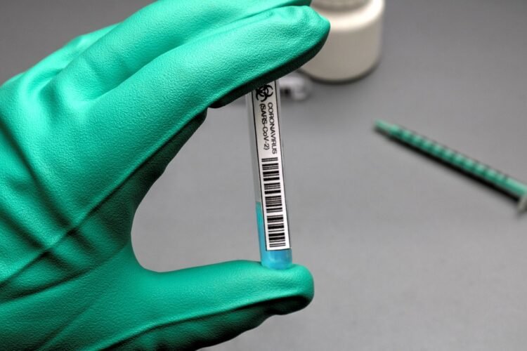 В РК выявлено 1208 заболевших с положительным ПЦР на коронавирусную инфекцию за сутки